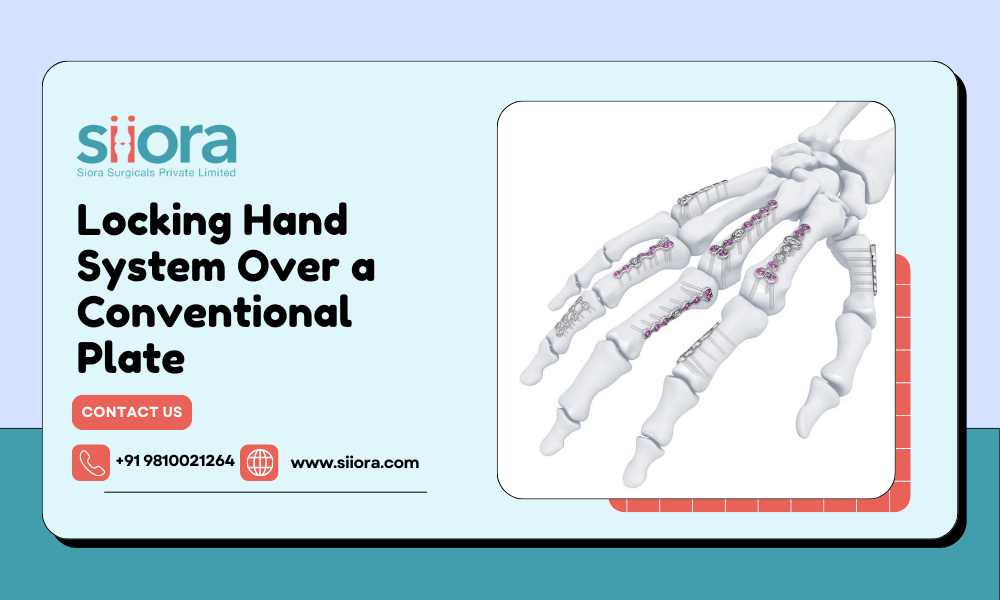 Why Choose a Locking Hand System Over a Conventional Plate